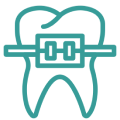 Braces Johor Bahru (JB) | Braces Skudai | Braces Impian Emas